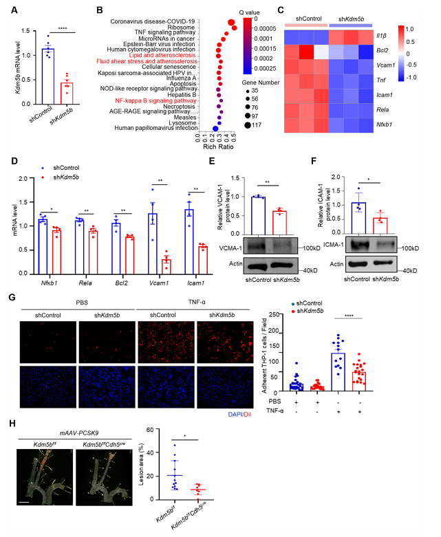 Piezo1 調控的內皮 KDM5B 參與紊亂血流誘導的動脈粥樣硬化斑塊形成
